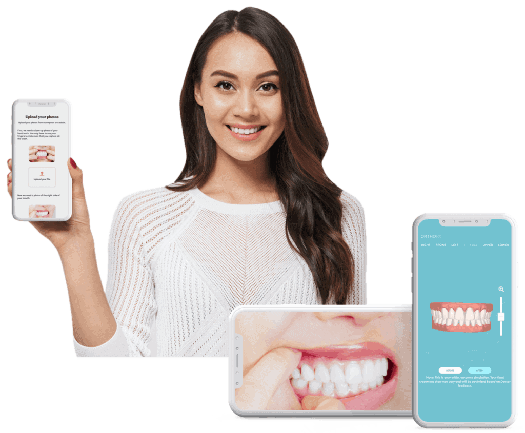 Best Teeth Straightening Aligners - OrthoFX