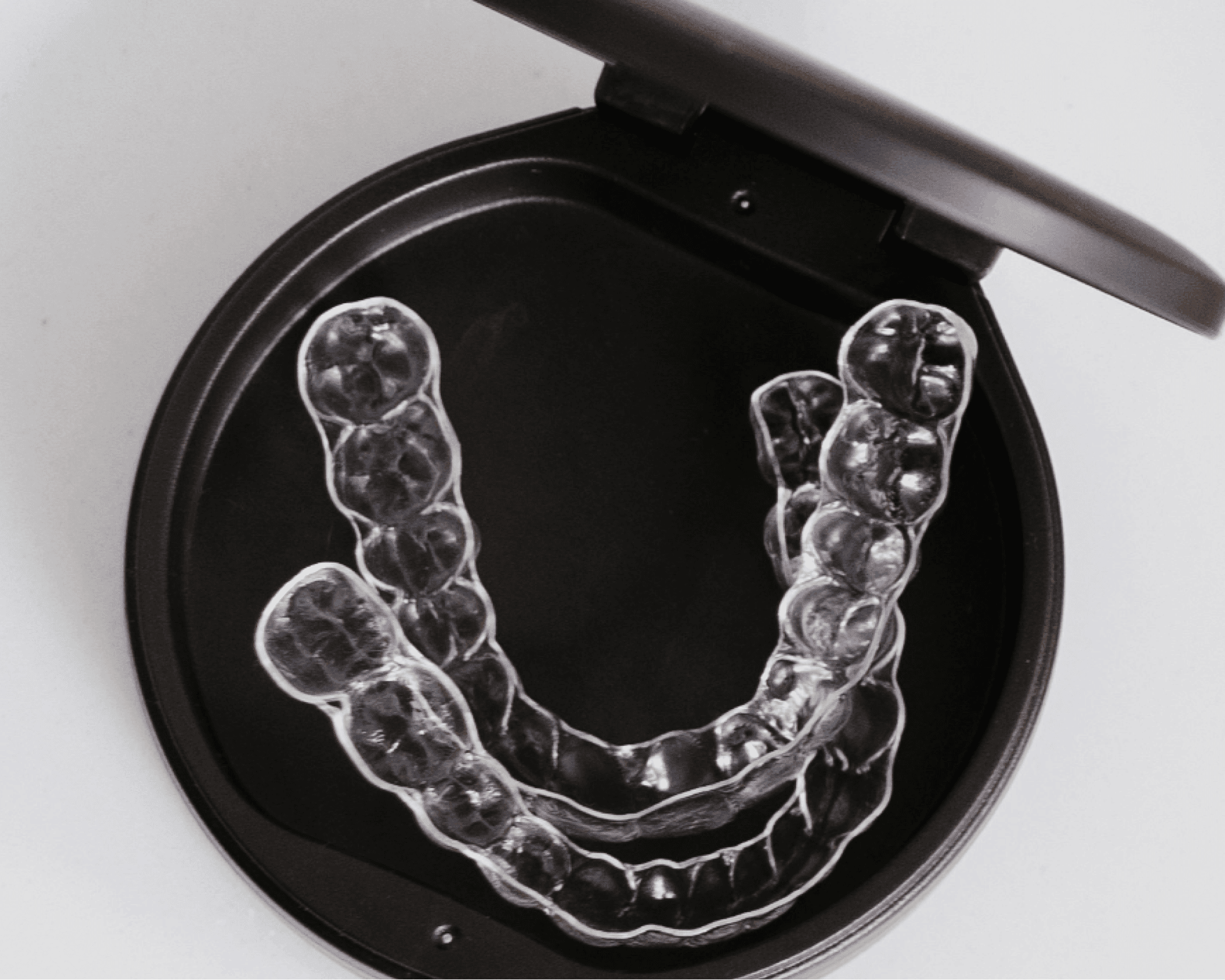 clear aligners