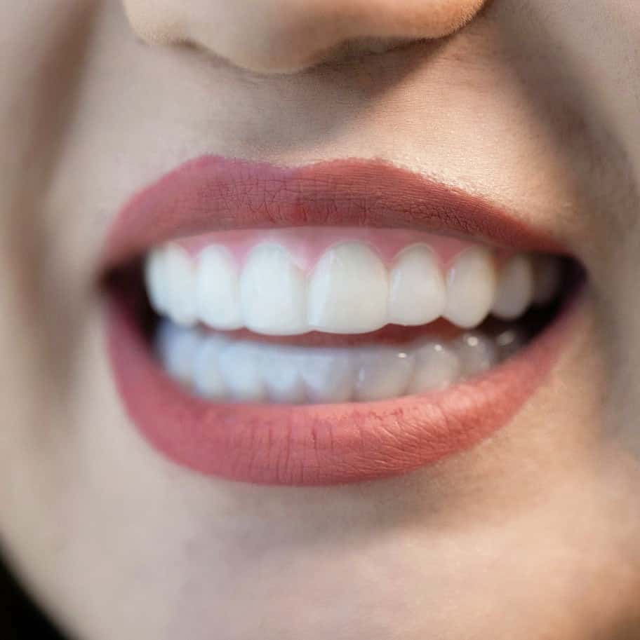 teeth straightening aligners