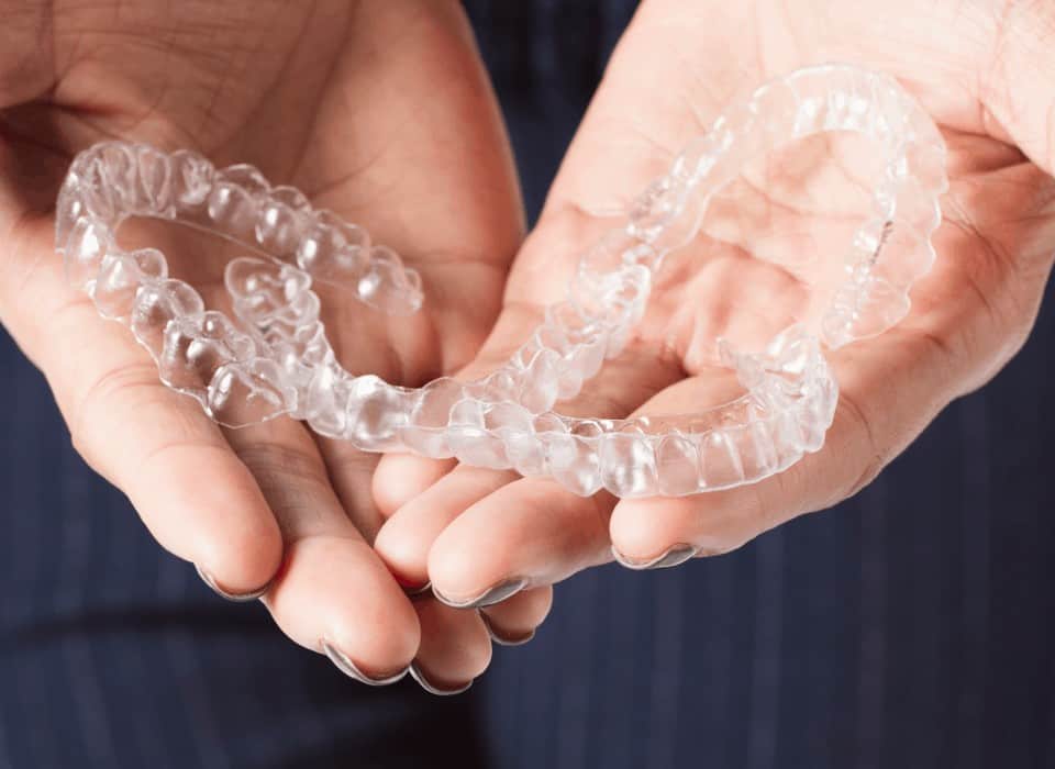 teeth aligners